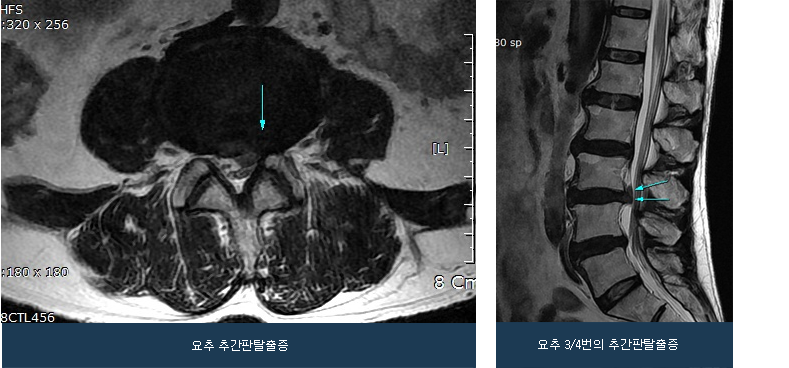 vertebra_02