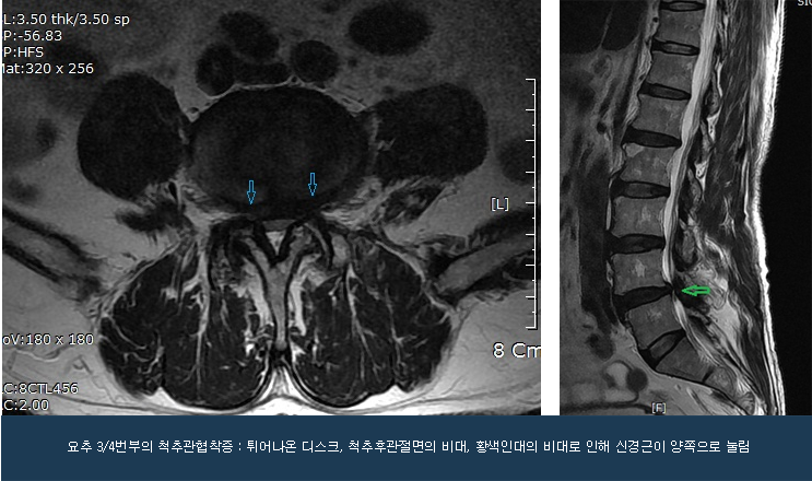 vertebra_01