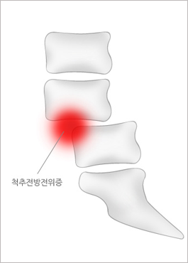 vertebra_01